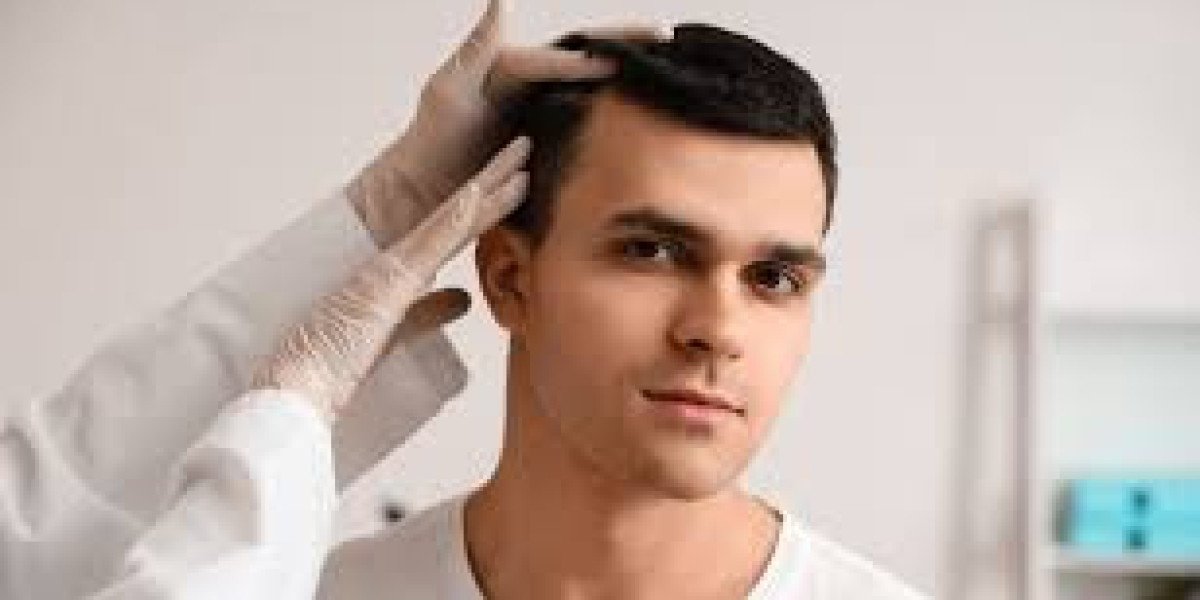 Questions to Ask Before Booking the Best Hair Transplant in Dubai