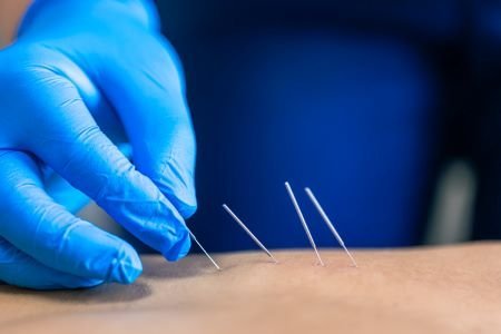 How Modern Tissue Therapy Relieves Pain and Boosts Recovery