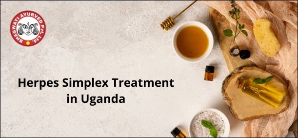 Herpes Simplex Treatment in Uganda - Bhagwati Ayurved